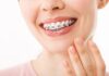 Wosk ortodontyczny – dlaczego warto go używać? Wyjaśniamy!